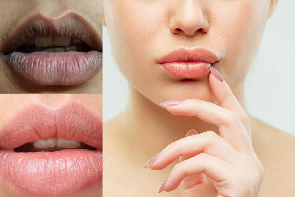 Make your lips pink naturally