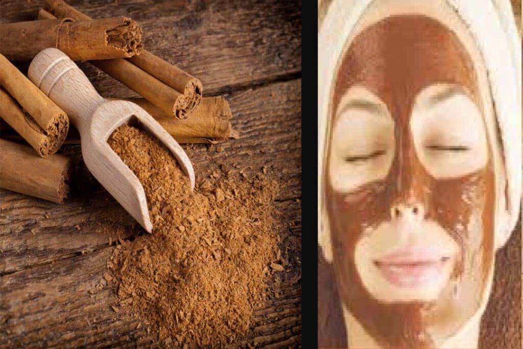 Benefits of cinnamon face pack: Pimples से परेशान हैं तो फेस पर लगाएं दालचीनी का पेस्ट, जानें बनाने की विधि