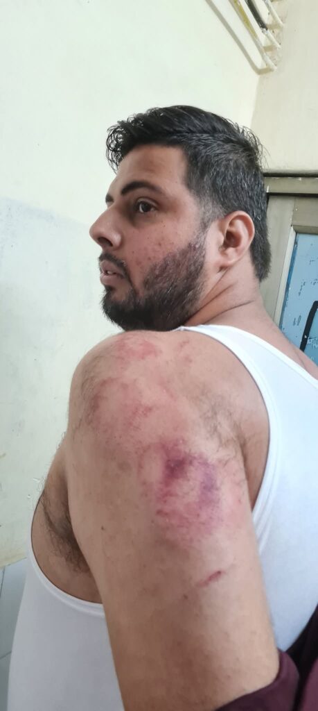 जालंधर: आप नेता से मारपीट के आरोप में पार्षद बंटी नीलकंठ पर केस दर्ज